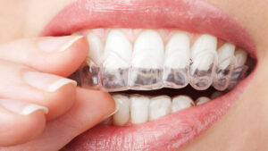 Estética Dental: Transformando Sorrisos e Confiança 19